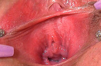 Free Logins Pussy My Gape s6